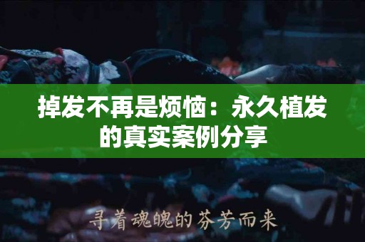 掉发不再是烦恼：永久植发的真实案例分享